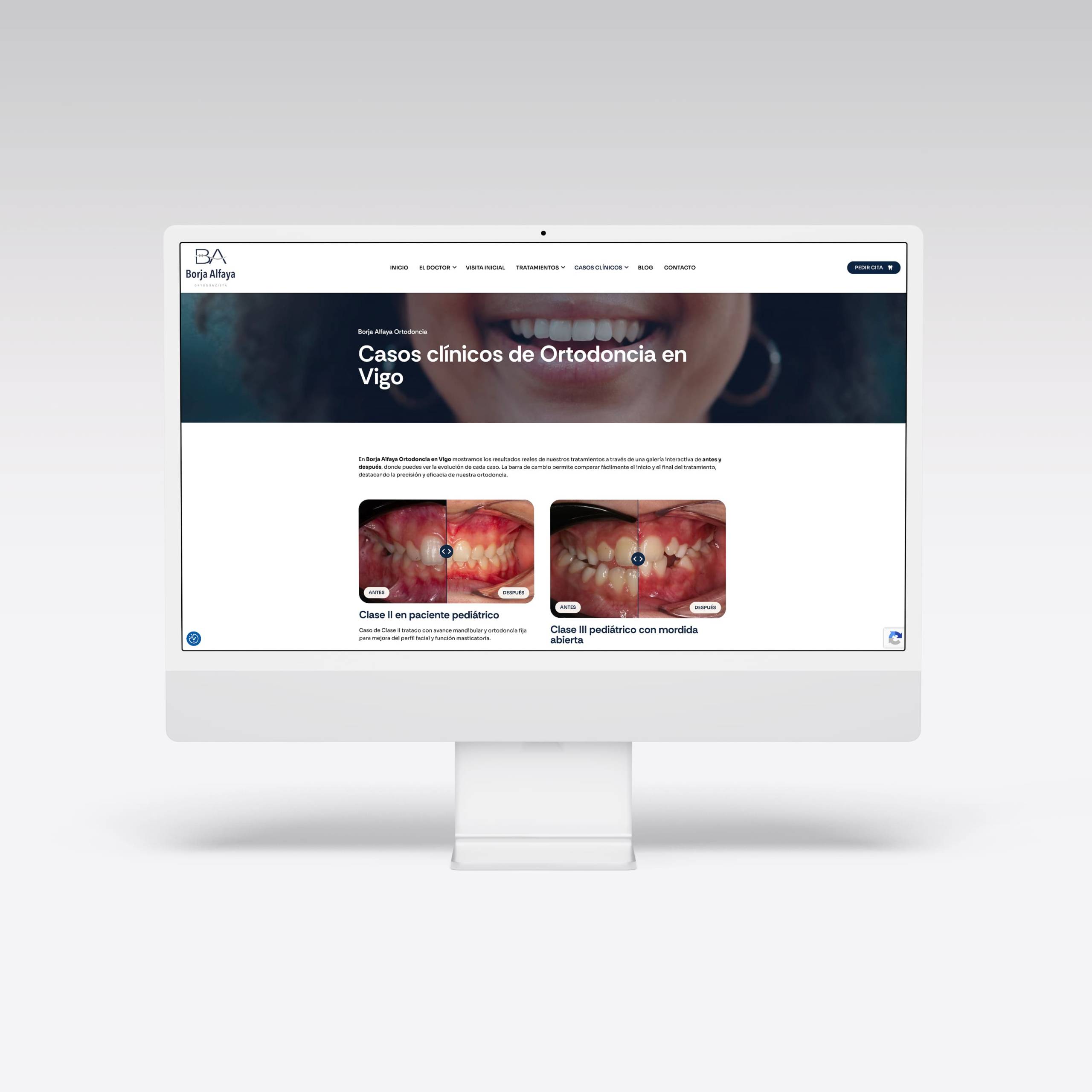 Web para Borja Alfaya - Agarimo Comunicación